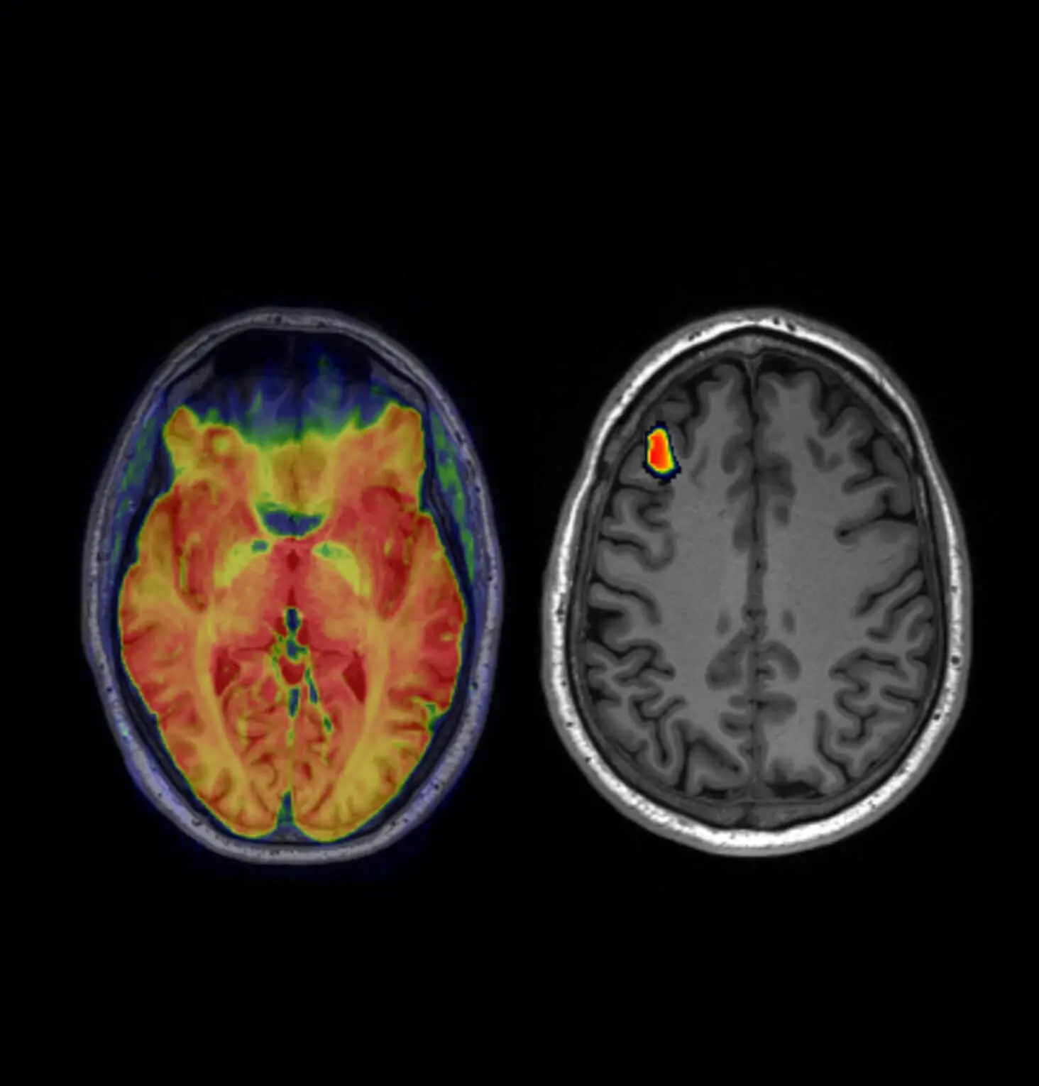 tab-image